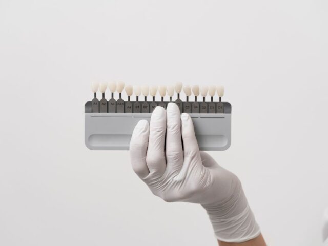 Transform Your Smile with Dental Veneers