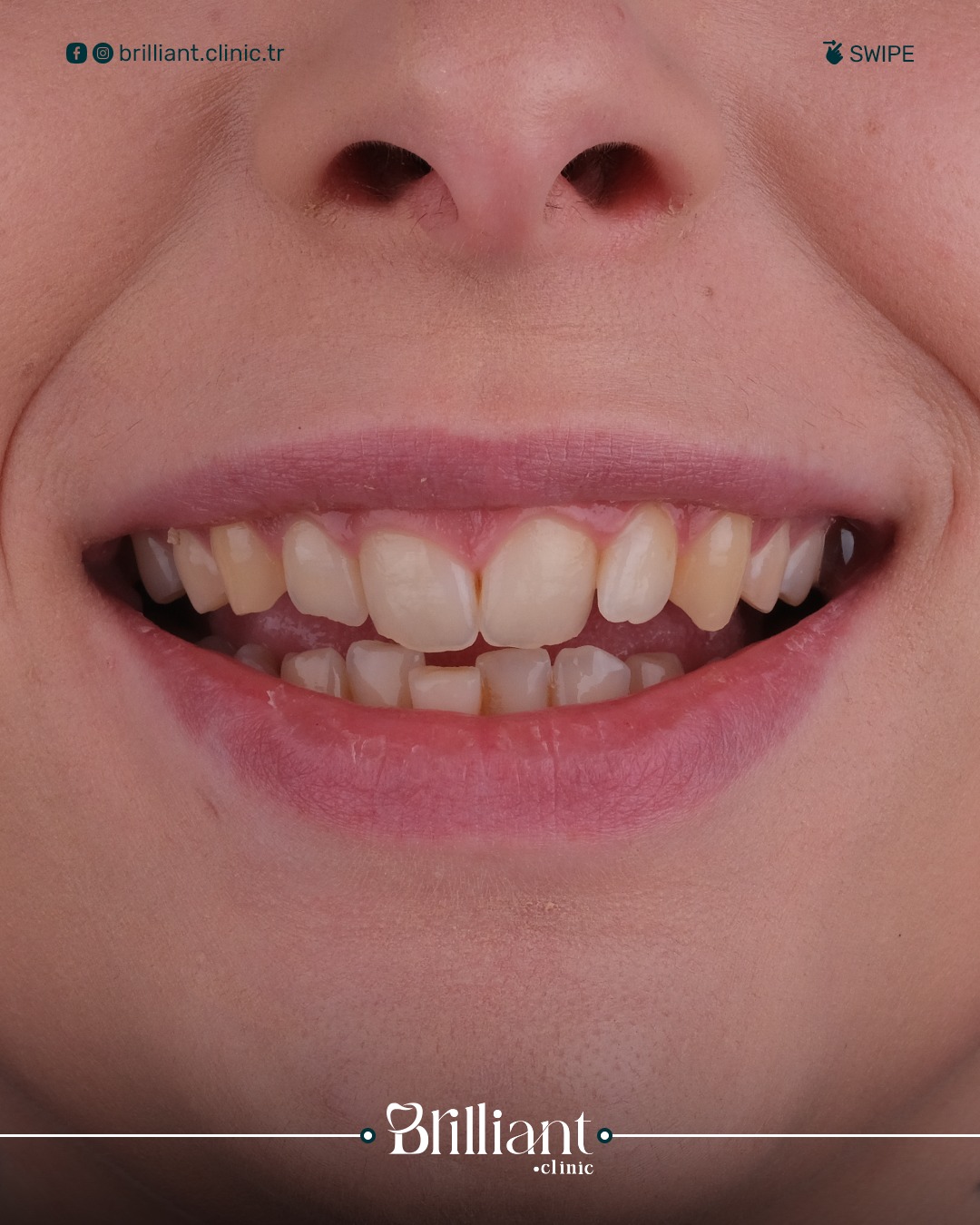 WhatsApp Image 2025-06-03 at 6.55.01 PM (5)