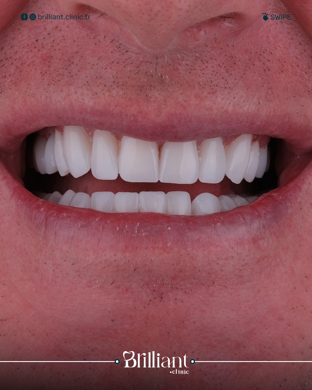 WhatsApp Image 2025-06-03 at 6.55.01 PM (6)