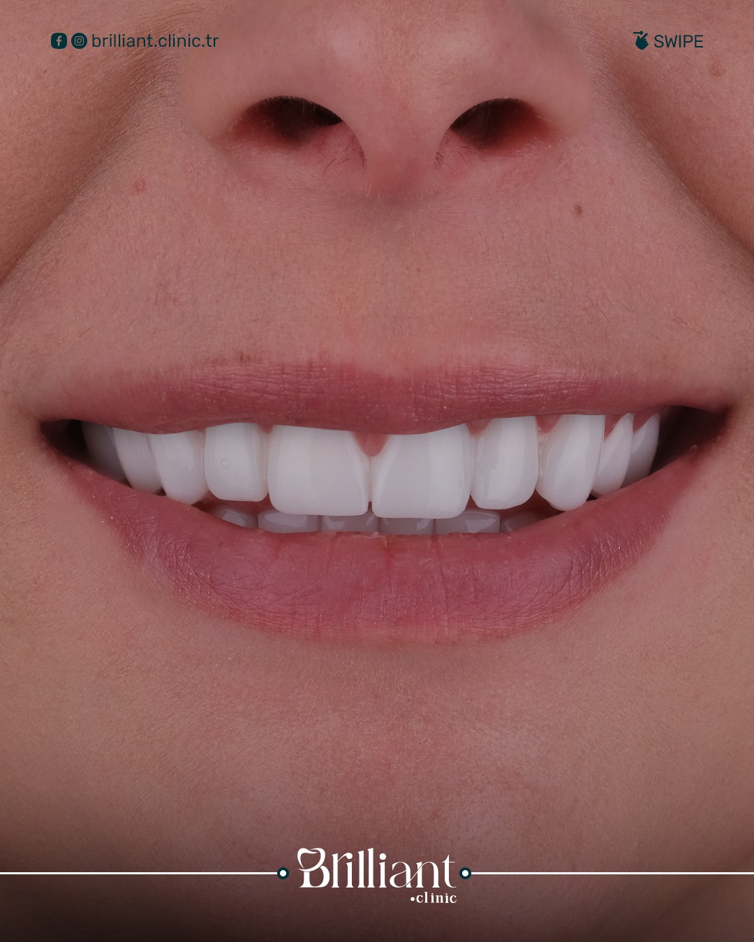 WhatsApp Image 2025-06-03 at 6.55.02 PM (3)