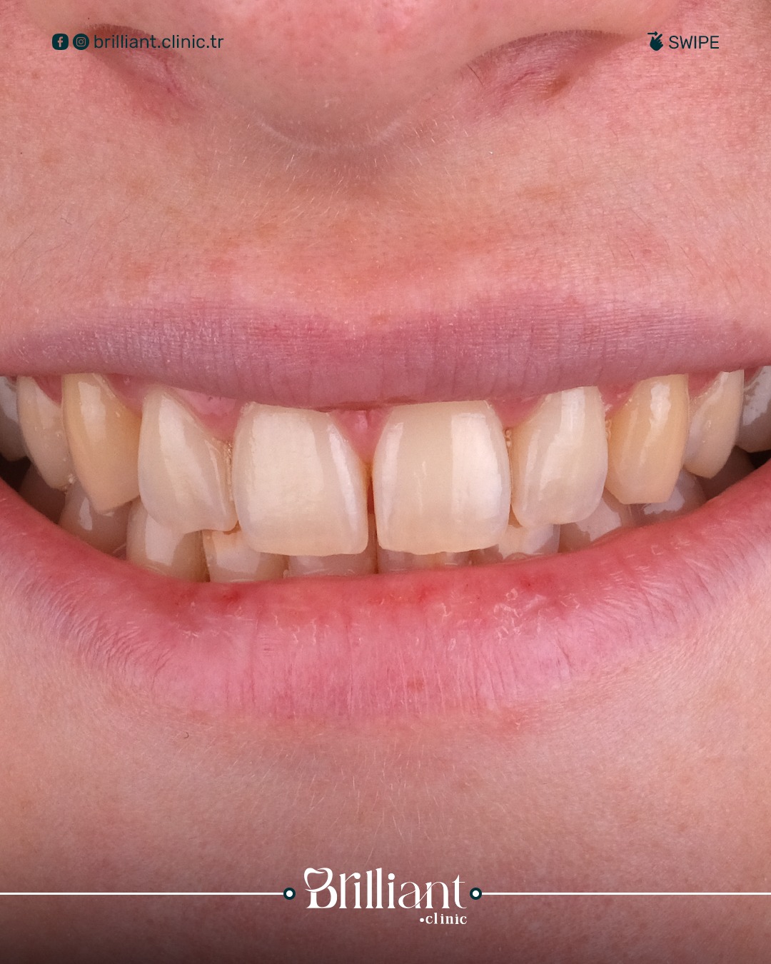 WhatsApp Image 2025-06-04 at 12.23.09 PM (2)