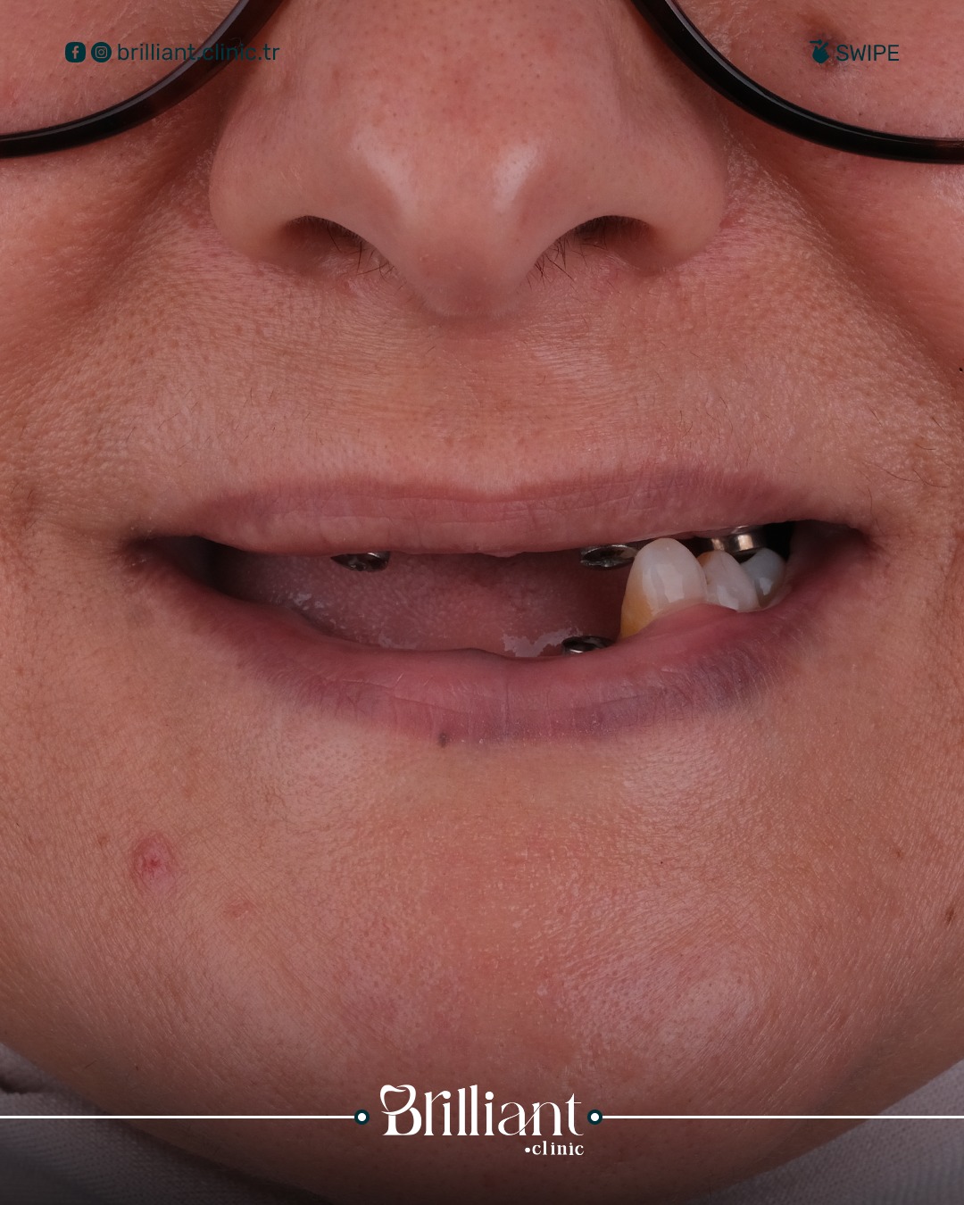 WhatsApp Image 2025-06-25 at 16.12.03_20473a62