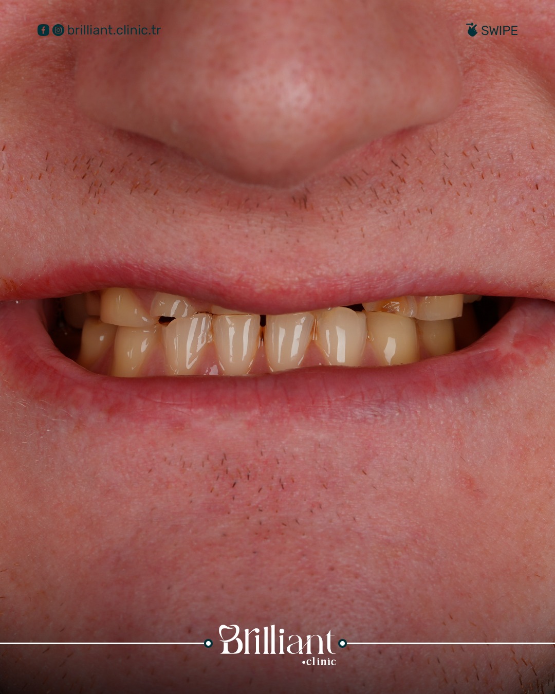 WhatsApp Image 2025-06-26 at 11.18.21_51add84f