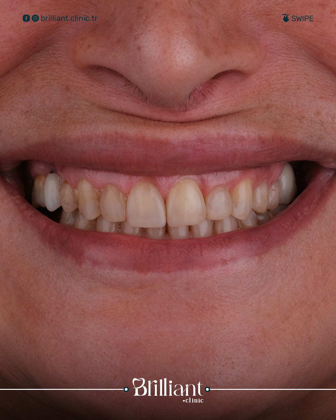 WhatsApp Image 2025-06-26 at 11.21.23_f27b4275