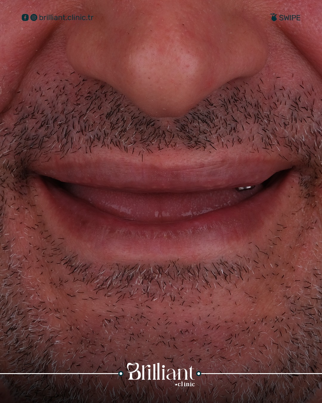 WhatsApp Image 2025-06-26 at 11.45.56_28ea30e7