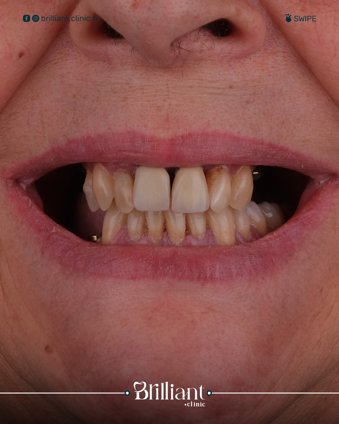 WhatsApp Image 2025-06-26 at 11.47.33_cd2fd7a6